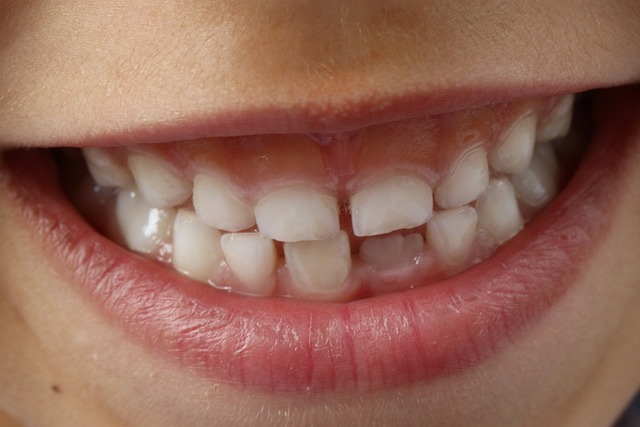 Tandlægebesøg: Hvordan du kan undgå dyre overraskelser